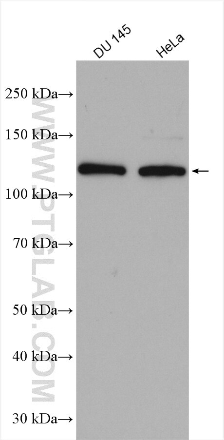Western Blot (WB) analysis of various lysates using HIP1 Polyclonal antibody (22231-1-AP)