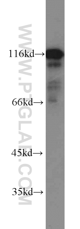 Western Blot (WB) analysis of human brain tissue using HIP1 Polyclonal antibody (22231-1-AP)