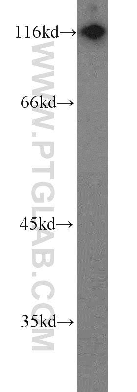 Western Blot (WB) analysis of A549 cells using HIP1 Polyclonal antibody (22231-1-AP)