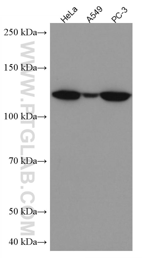 Western Blot (WB) analysis of various lysates using HIP1 Monoclonal antibody (67163-1-Ig)