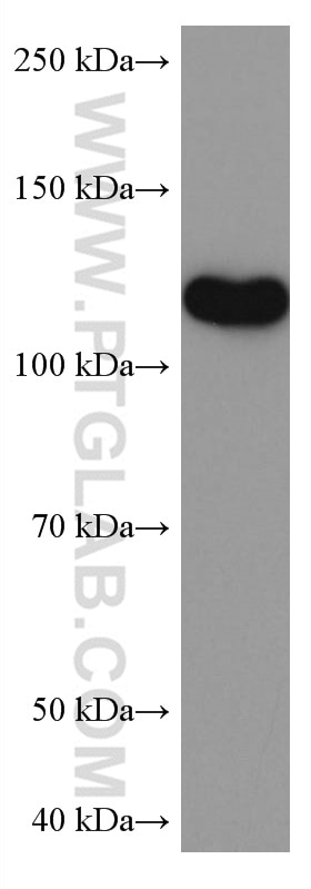 WB analysis of pig brain using 67163-1-Ig