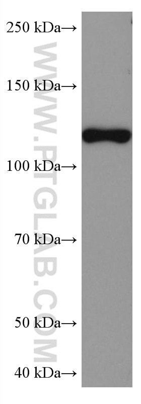 Western Blot (WB) analysis of mouse brain tissue using HIP1 Monoclonal antibody (67163-1-Ig)