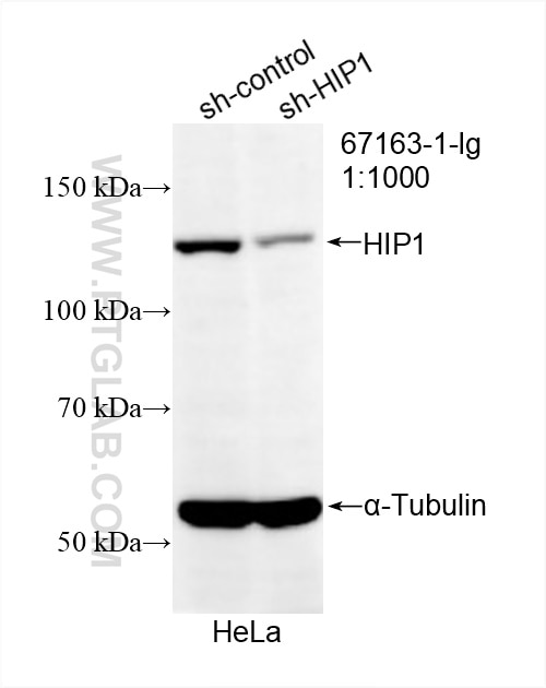 Western Blot (WB) analysis of HeLa cells using HIP1 Monoclonal antibody (67163-1-Ig)