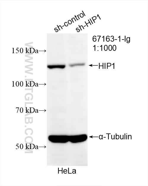 WB analysis of HeLa using 67163-1-Ig