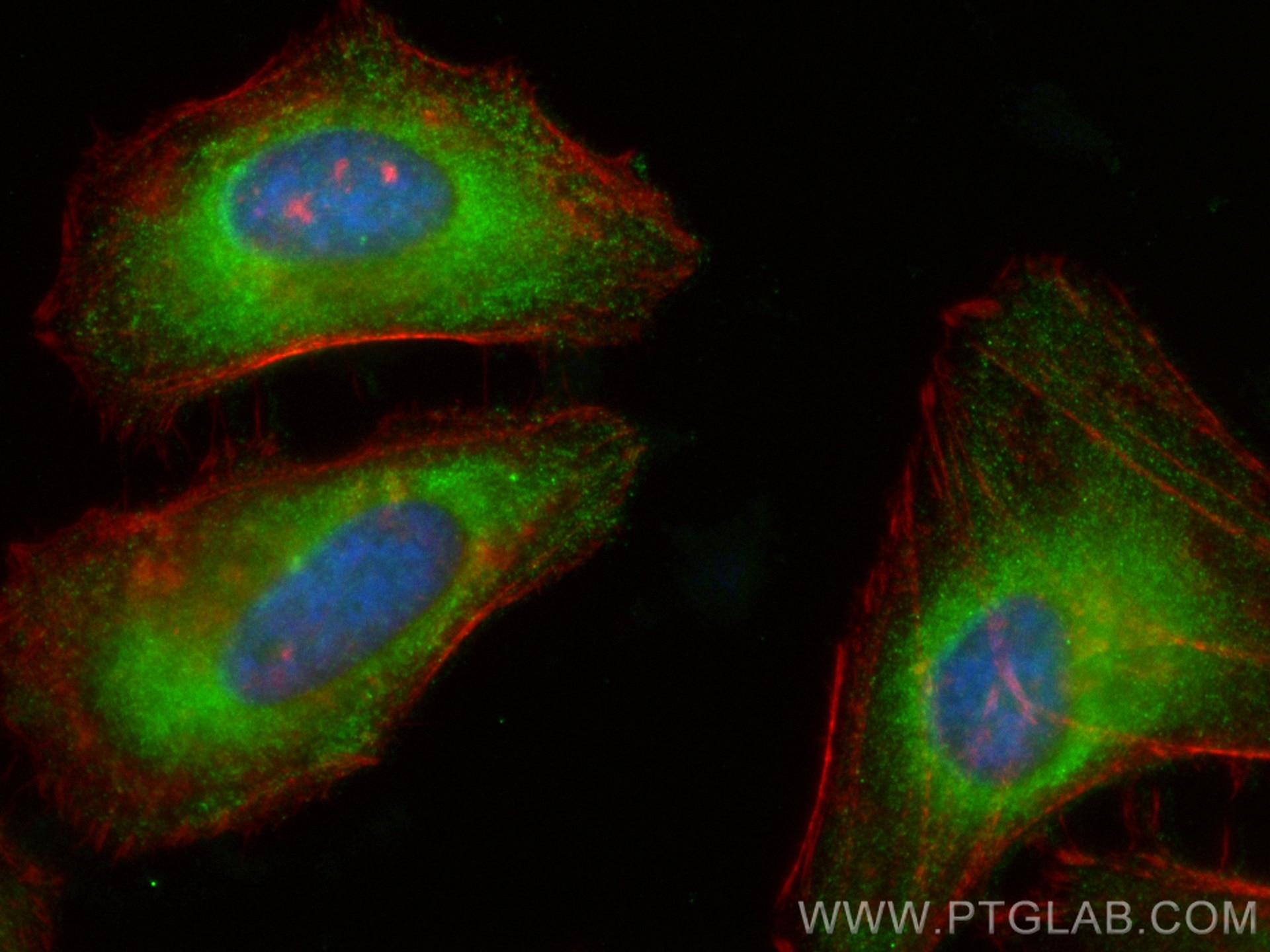 Immunofluorescence (IF) / fluorescent staining of HeLa cells using CoraLite® Plus 488-conjugated HIP1 Polyclonal anti (CL488-22231)