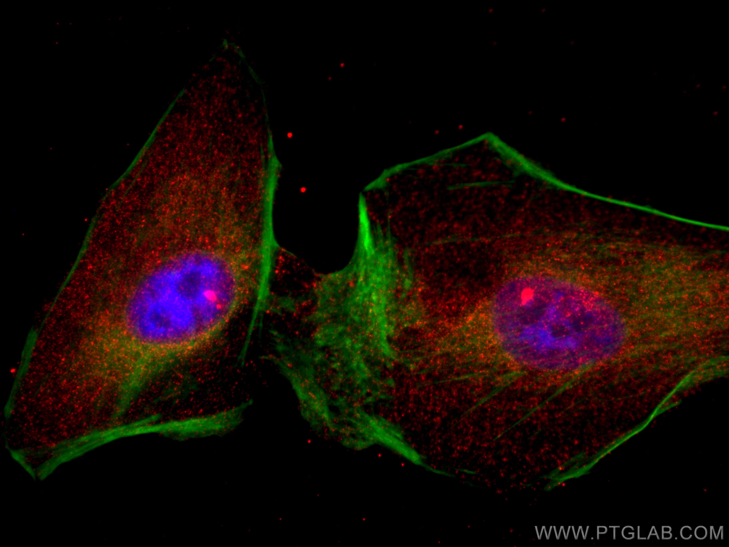 Immunofluorescence (IF) / fluorescent staining of A549 cells using CoraLite®594-conjugated HIP1 Monoclonal antibody (CL594-67163)