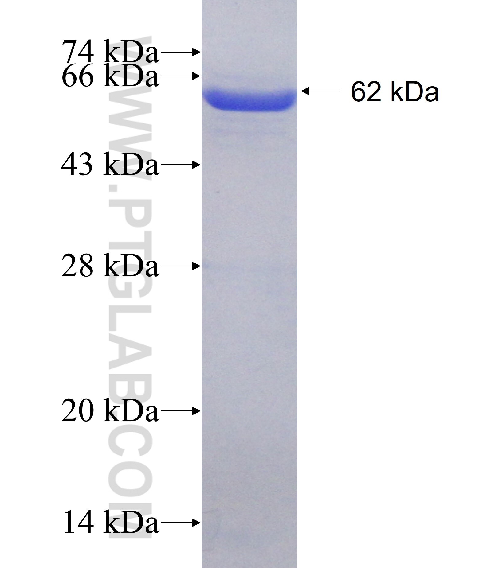 HIP1 fusion protein Ag17576 SDS-PAGE