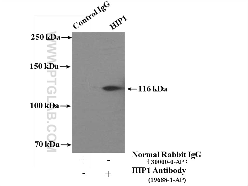 Immunoprecipitation (IP) experiment of HEK-293 cells using HIP1-Specific Polyclonal antibody (19688-1-AP)