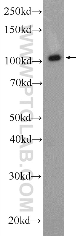 Western Blot (WB) analysis of HEK-293 cells using HIP1-Specific Polyclonal antibody (19688-1-AP)