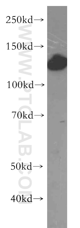 Western Blot (WB) analysis of COLO 320 cells using HIP1-Specific Polyclonal antibody (19688-1-AP)