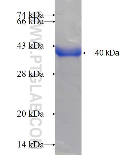 HIP14; ZDHHC17 fusion protein Ag7763 SDS-PAGE