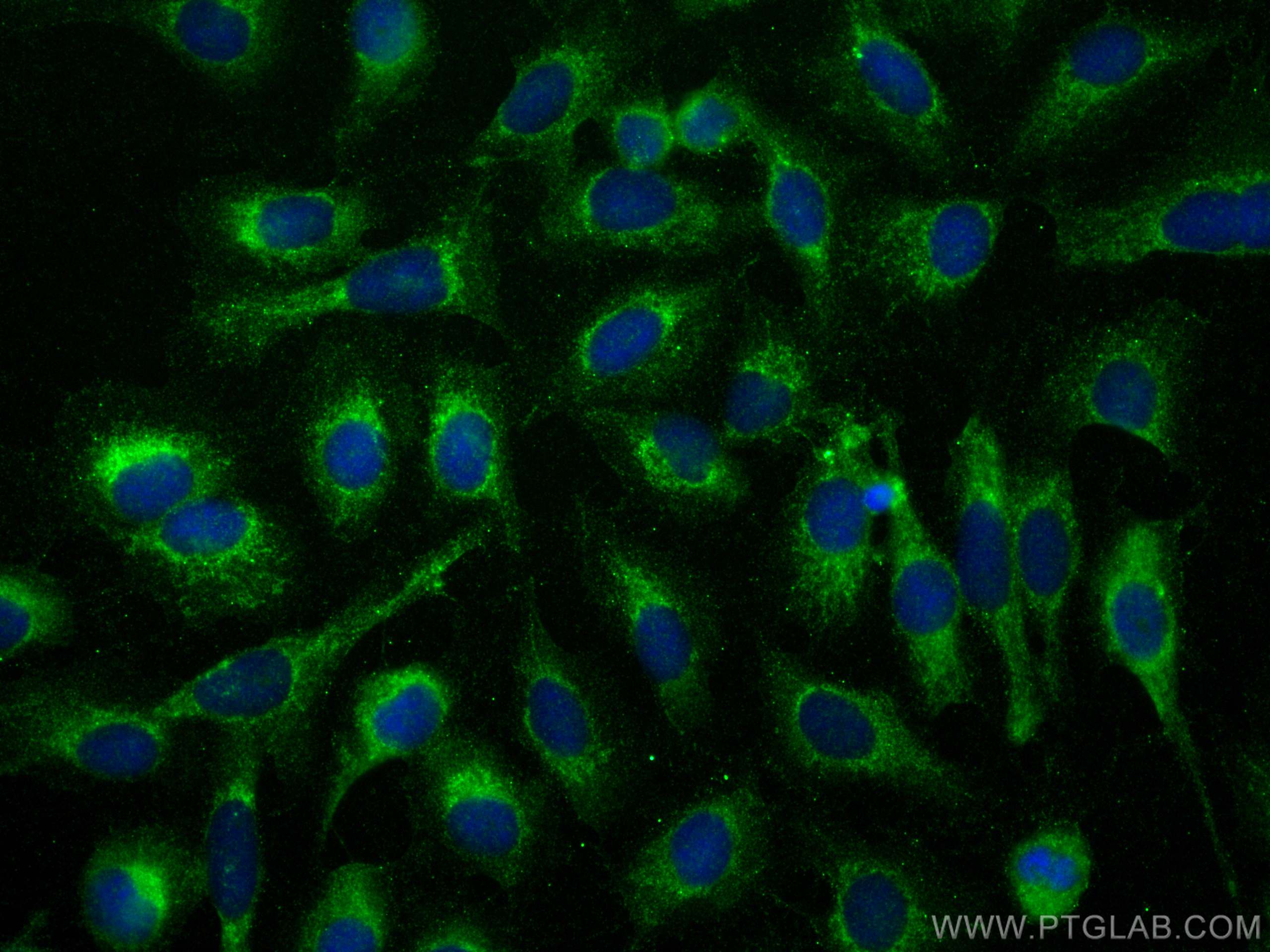 Immunofluorescence (IF) / fluorescent staining of U2OS cells using HIP14; ZDHHC17 Polyclonal antibody (30022-1-AP)