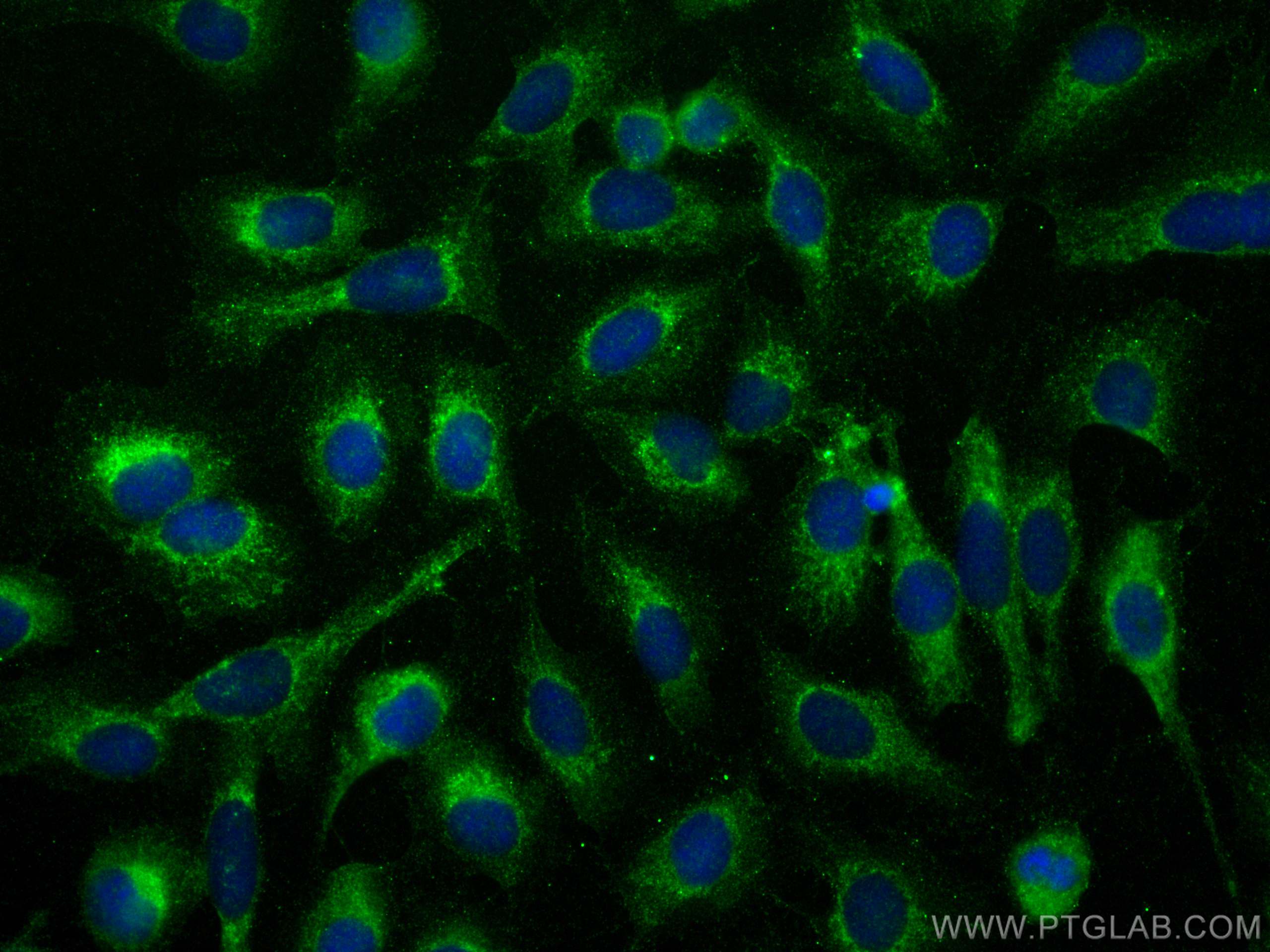 IF Staining of U2OS using 30022-1-AP