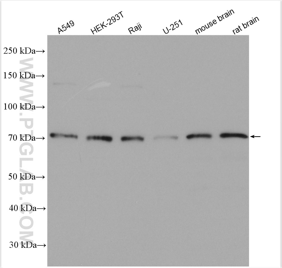 Western Blot (WB) analysis of various lysates using HIP14; ZDHHC17 Polyclonal antibody (30022-1-AP)