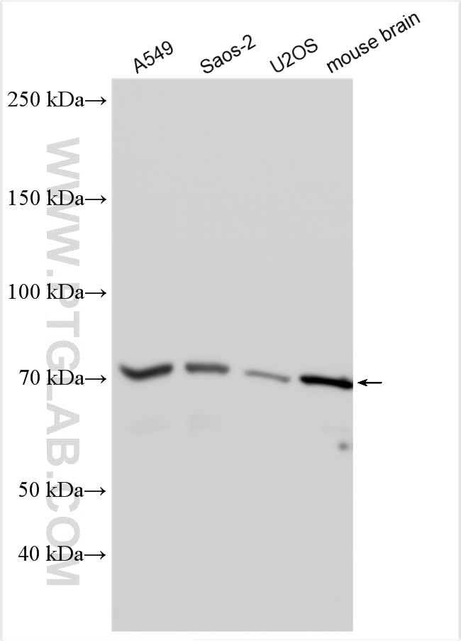 Western Blot (WB) analysis of various lysates using HIP14; ZDHHC17 Polyclonal antibody (30022-1-AP)