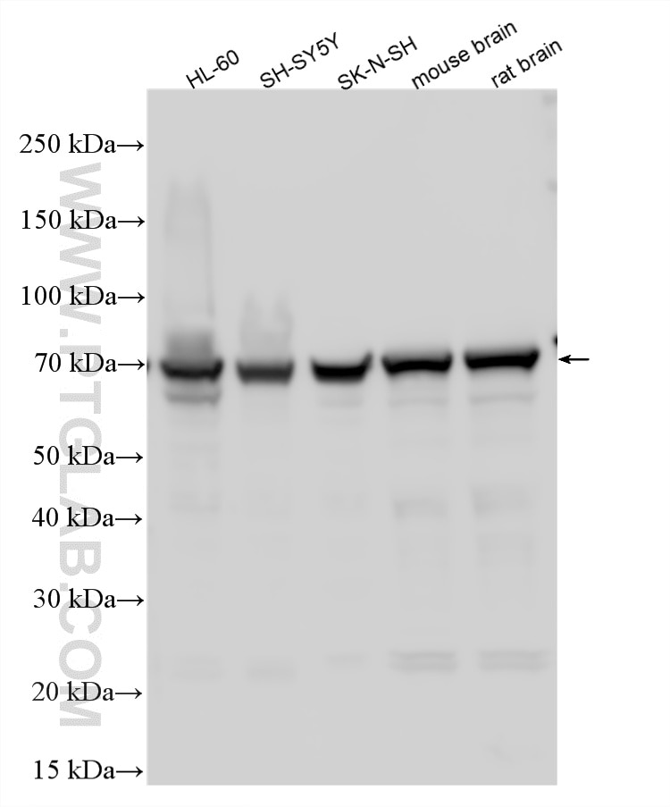 WB analysis using 30022-1-AP Western Blot (WB) analysis of various lysates using HIP14/ZDHHC17 Polyclonal antibody (30022-1-AP)