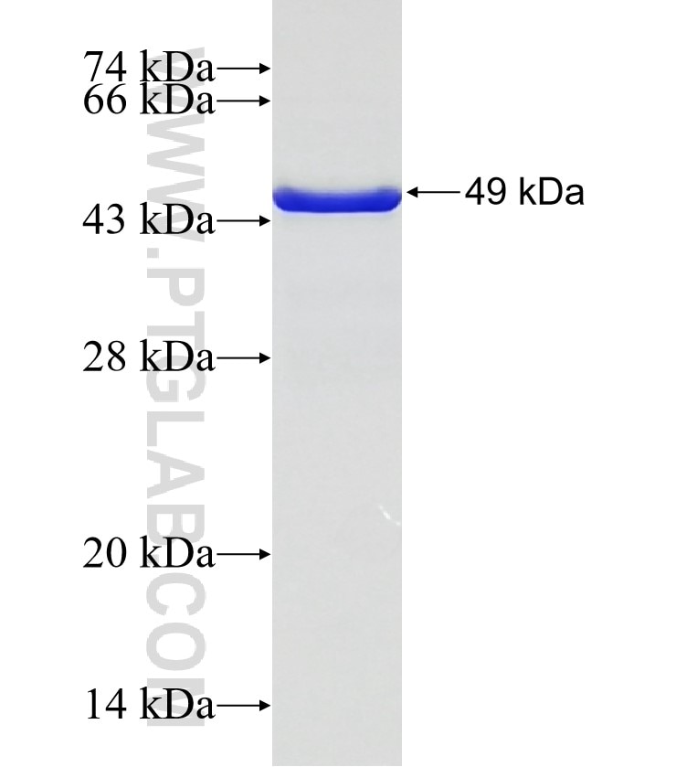 HIP14; ZDHHC17 fusion protein Ag32654 SDS-PAGE