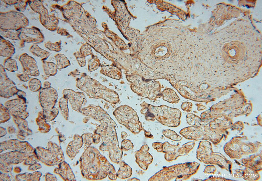 Immunohistochemistry (IHC) staining of human placenta tissue using HIP1R Polyclonal antibody (16814-1-AP)