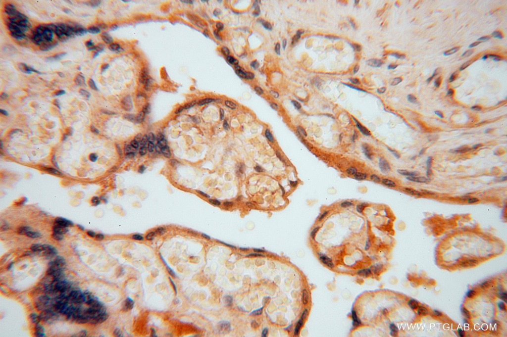 Immunohistochemistry (IHC) staining of human placenta tissue using HIP1R Polyclonal antibody (16814-1-AP)
