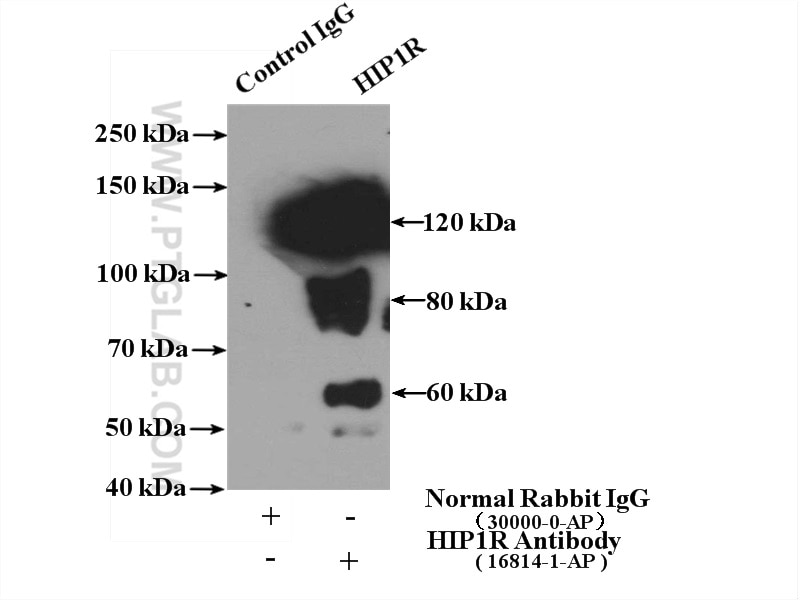 Immunoprecipitation (IP) experiment of mouse brain tissue using HIP1R Polyclonal antibody (16814-1-AP)