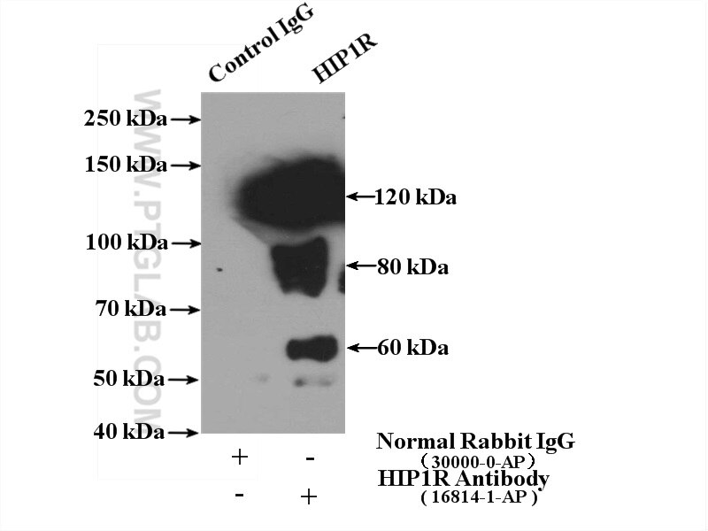 Immunoprecipitation (IP) experiment of mouse brain tissue using HIP1R Polyclonal antibody (16814-1-AP)