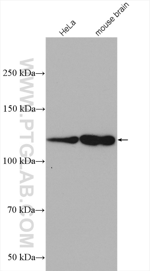 Western Blot (WB) analysis of various lysates using HIP1R Polyclonal antibody (16814-1-AP)