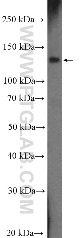 WB analysis of HeLa using 16814-1-AP