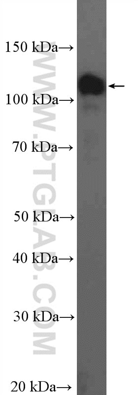 Western Blot (WB) analysis of mouse brain tissue using HIP1R Polyclonal antibody (16814-1-AP)