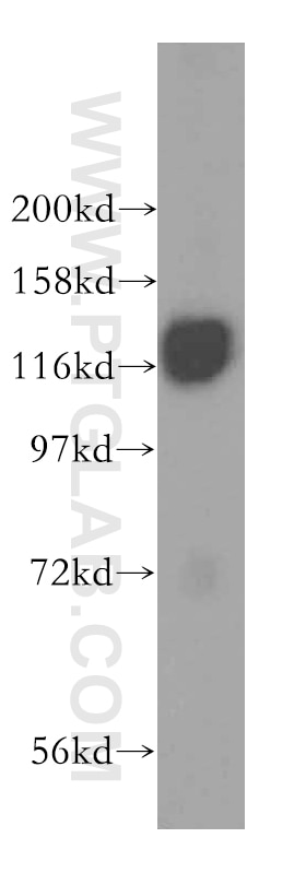 Western Blot (WB) analysis of mouse lung tissue using HIP1R Polyclonal antibody (16814-1-AP)
