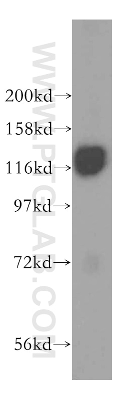 WB analysis of mouse lung using 16814-1-AP