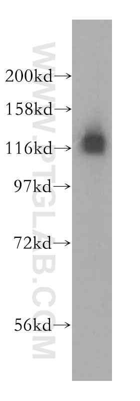 Western Blot (WB) analysis of mouse heart tissue using HIP1R Polyclonal antibody (16814-1-AP)