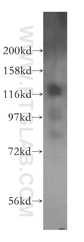 Western Blot (WB) analysis of human liver tissue using HIP1R Polyclonal antibody (16814-1-AP)