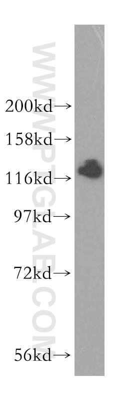 Western Blot (WB) analysis of mouse kidney tissue using HIP1R Polyclonal antibody (16814-1-AP)