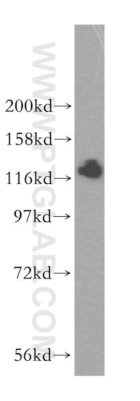 WB analysis of mouse kidney using 16814-1-AP