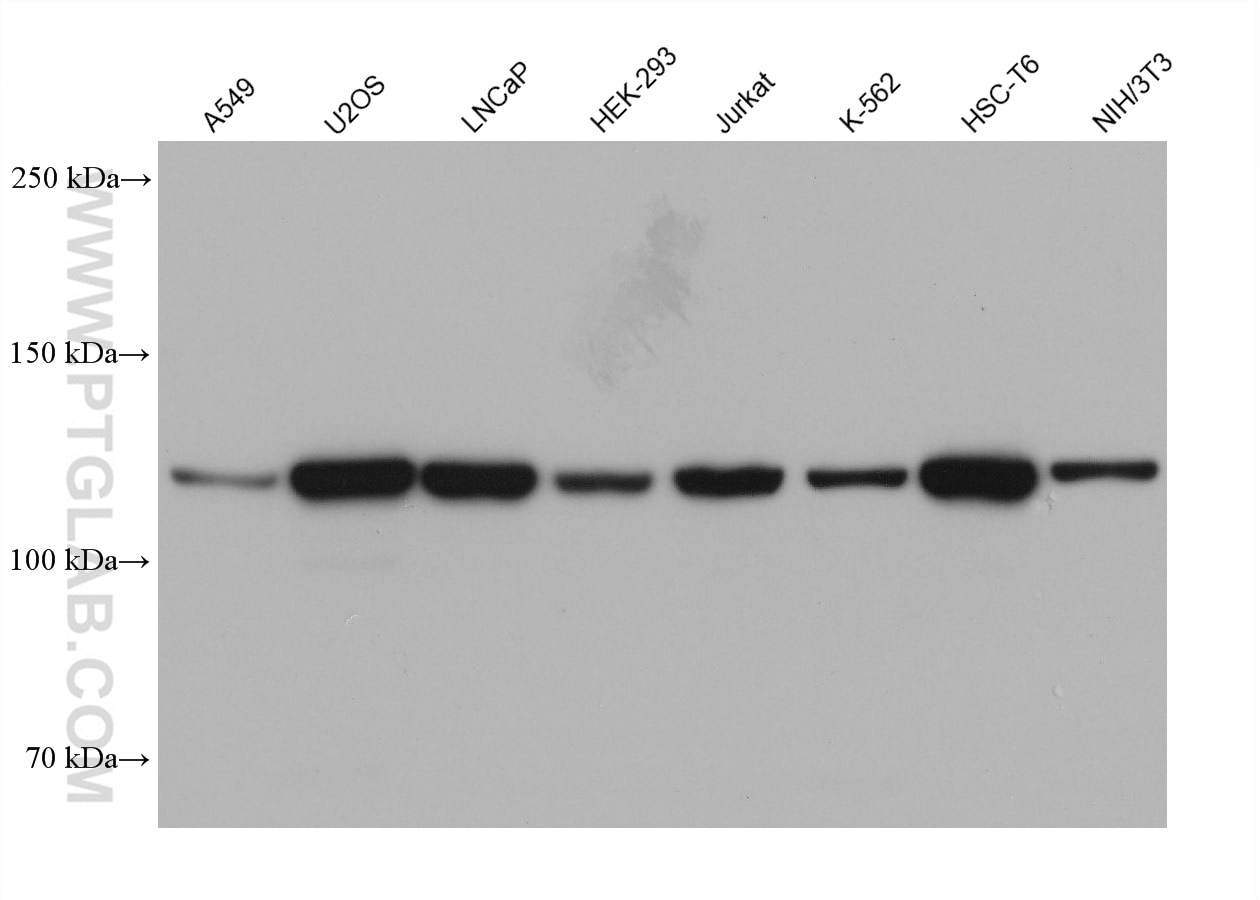 Western Blot (WB) analysis of various lysates using HIP1R Monoclonal antibody (68403-1-Ig)