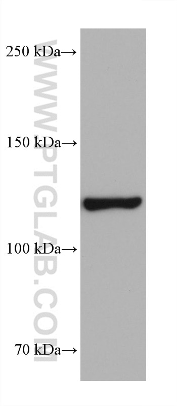 Western Blot (WB) analysis of 4T1 cells using HIP1R Monoclonal antibody (68403-1-Ig)