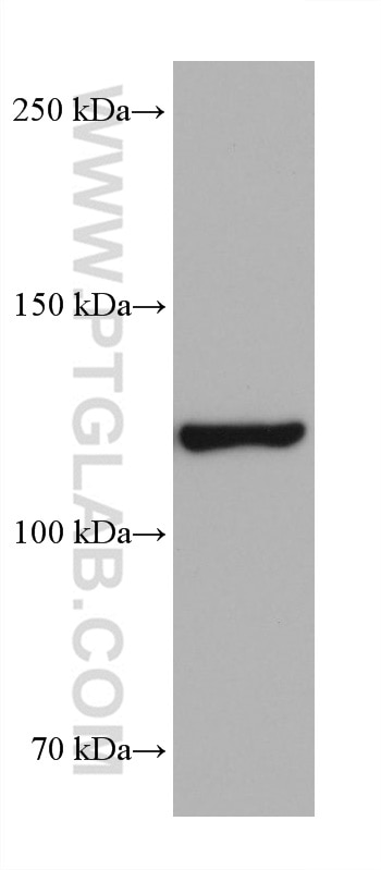 WB analysis of 4T1 using 68403-1-Ig