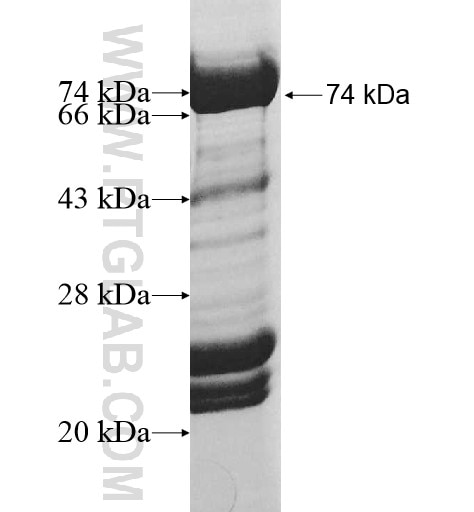 HIP1R fusion protein Ag10353 SDS-PAGE