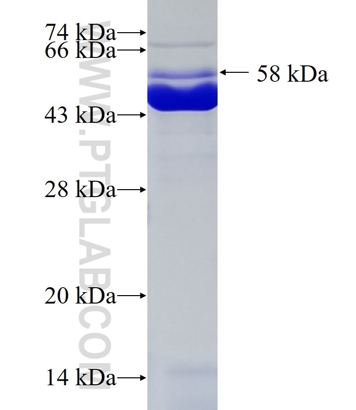 HIP1R fusion protein Ag10657 SDS-PAGE