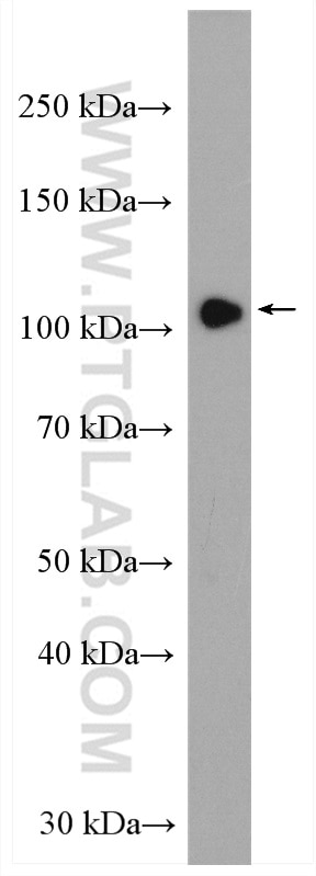 Western Blot (WB) analysis of mouse kidney tissue using HIPK2 Polyclonal antibody (55408-1-AP)