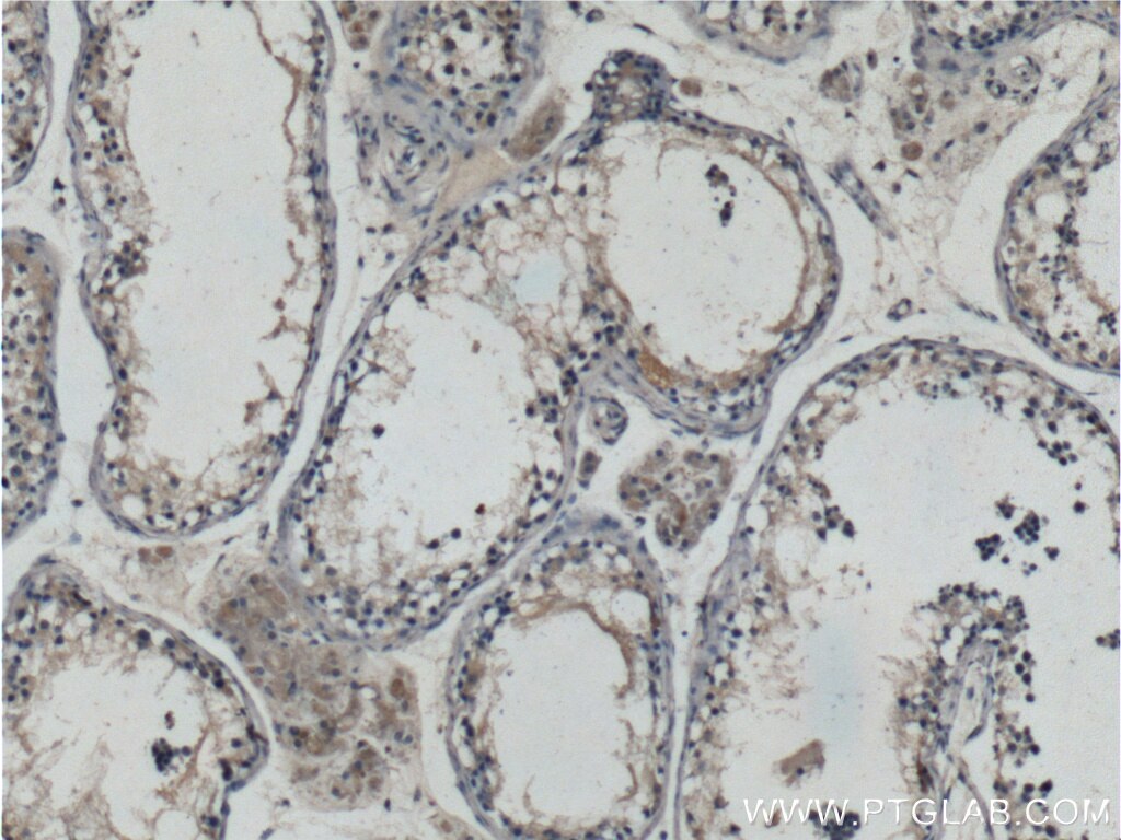 Immunohistochemistry (IHC) staining of human testis tissue using HIPK3 Polyclonal antibody (25107-1-AP)