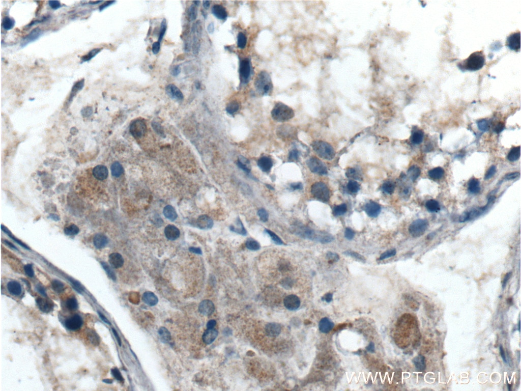 IHC staining of human testis using 25107-1-AP