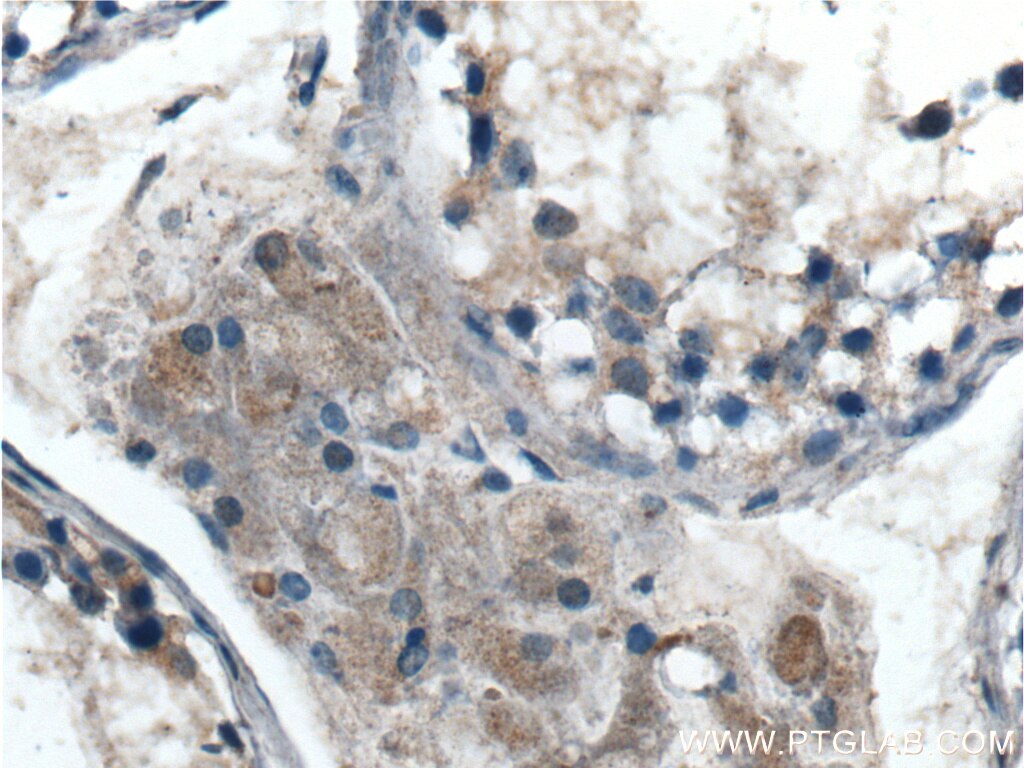 Immunohistochemistry (IHC) staining of human testis tissue using HIPK3 Polyclonal antibody (25107-1-AP)