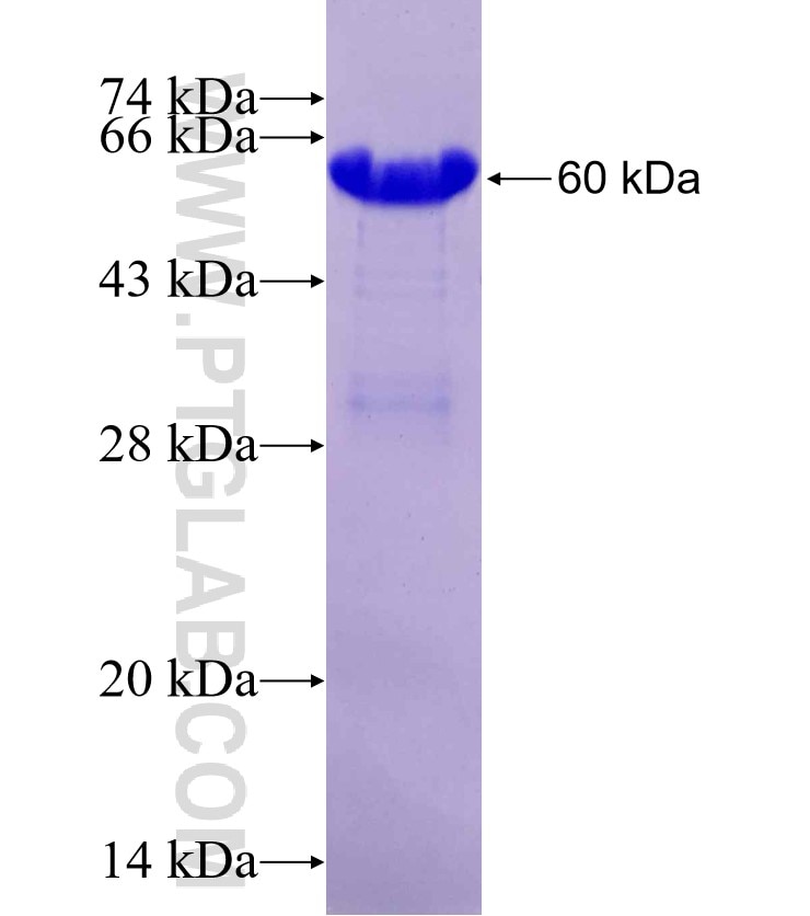 HIPK3 fusion protein Ag18897 SDS-PAGE