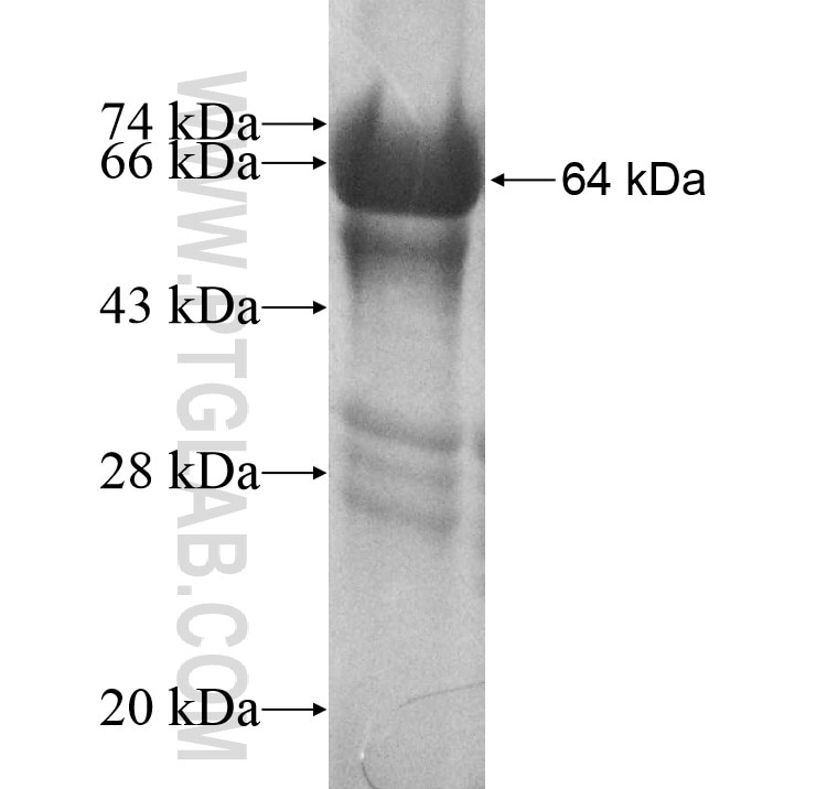 HIPK4 fusion protein Ag10811 SDS-PAGE