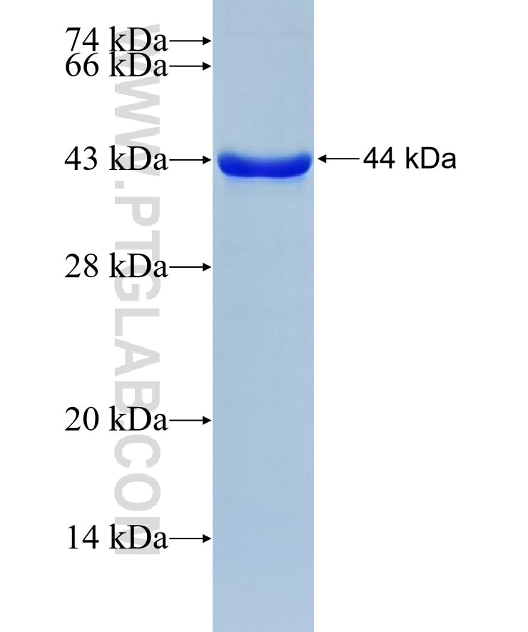 HIPK4 fusion protein Ag10828 SDS-PAGE