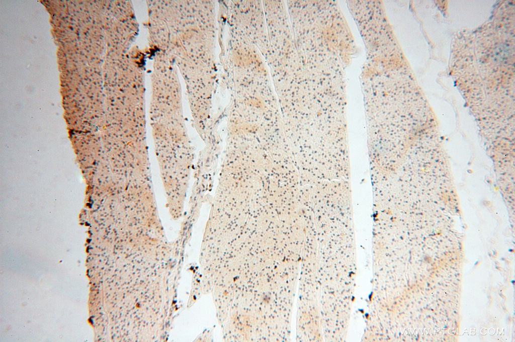 Immunohistochemistry (IHC) staining of human heart tissue using HIRIP3 Polyclonal antibody (14992-1-AP)