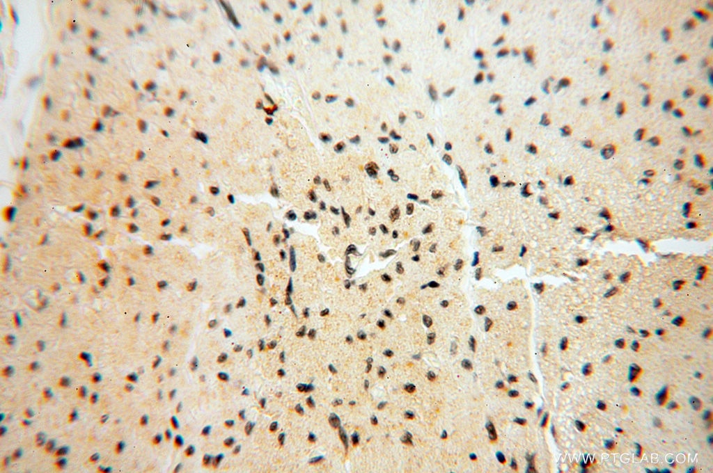 Immunohistochemistry (IHC) staining of human heart tissue using HIRIP3 Polyclonal antibody (14992-1-AP)