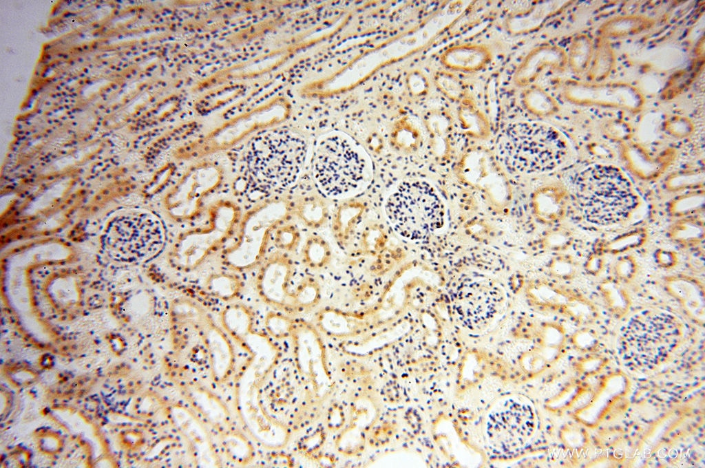 Immunohistochemistry (IHC) staining of human kidney tissue using HIRIP3 Polyclonal antibody (14992-1-AP)