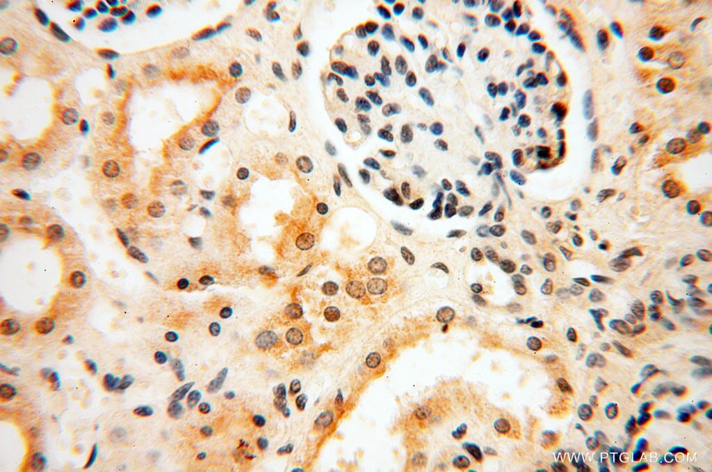 Immunohistochemistry (IHC) staining of human kidney tissue using HIRIP3 Polyclonal antibody (14992-1-AP)